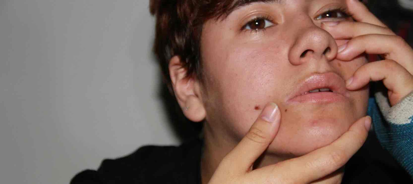 Pubertät bei Jungen Junge fasst sich ans Gesicht